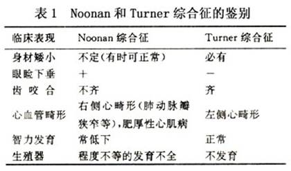 小儿先天性侏儒痴呆综合征