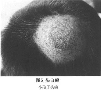 黑点癣  初发损害为较小白色鳞屑斑,散在分布,炎症轻微或无炎症,有时