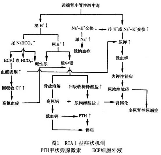 远侧肾小管酸中毒