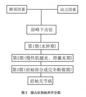 肩峰下撞击征