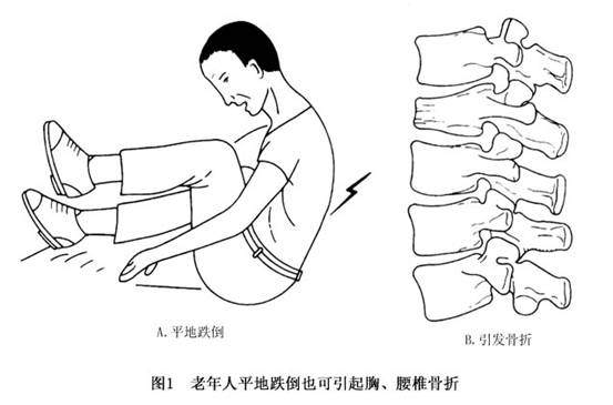 腰背疼痛病人的心理治疗与护理