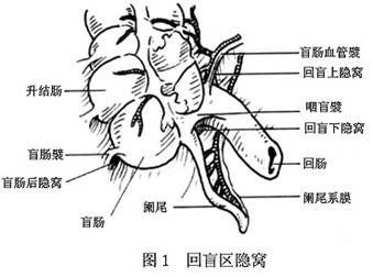 回盲上隐窝和回盲下隐窝是回肠动脉分支时,腹膜发生皱褶形成的.