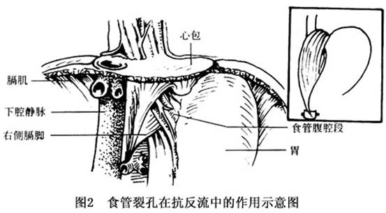 胸腹腔之间的压力差作用,膈肌脚的弹簧正常食管裂孔由左膈肌第1～4