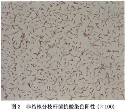 用金胺-若丹明(auramine-rhodamine)对涂片进行荧光染色后镜检,敏感性