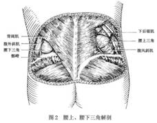 腰疝