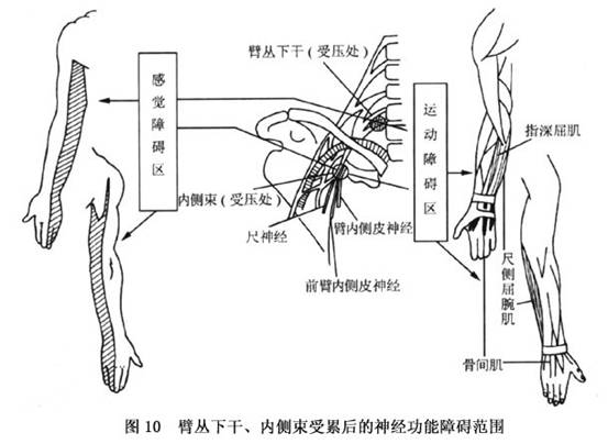 ③adson征:多