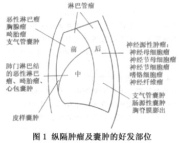 纵隔肿瘤