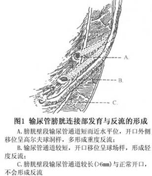 管肌层主要由疏松不规则螺旋形肌纤维组成,进入膀胱壁段才呈纵行纤维