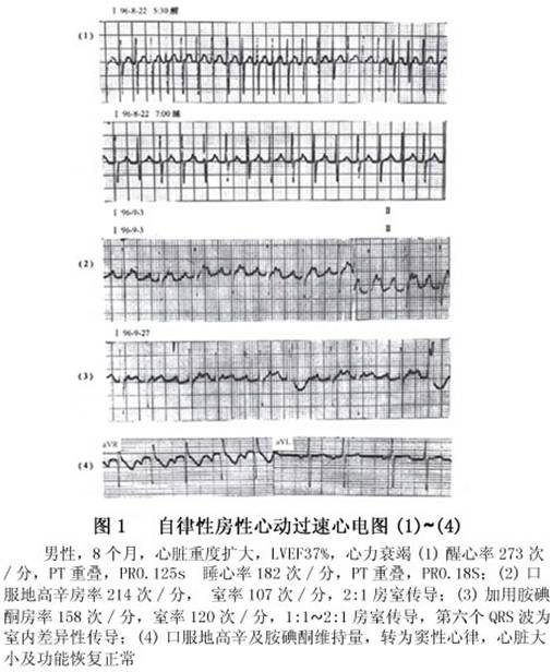 1.心电图特点     (1)房性心动过速:发作持续1个月以上.