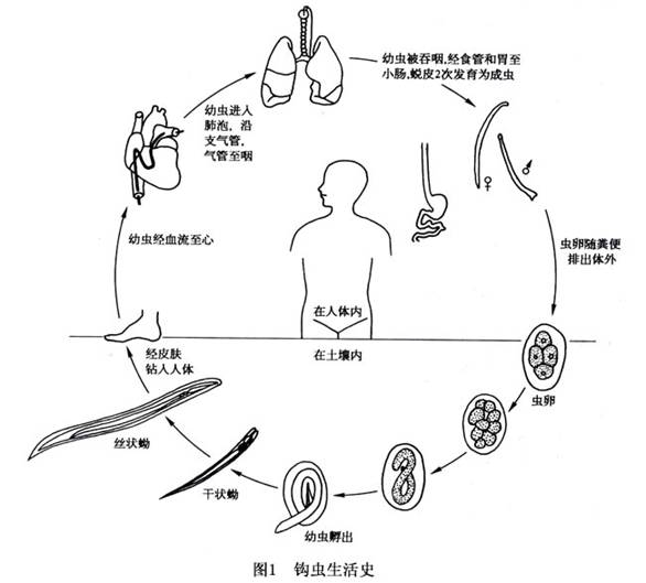 钩虫病