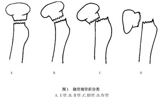 桡骨颈骨折和桡骨头骨骺分离