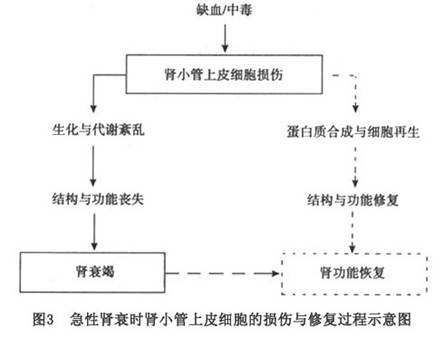 老年急性肾功能衰竭