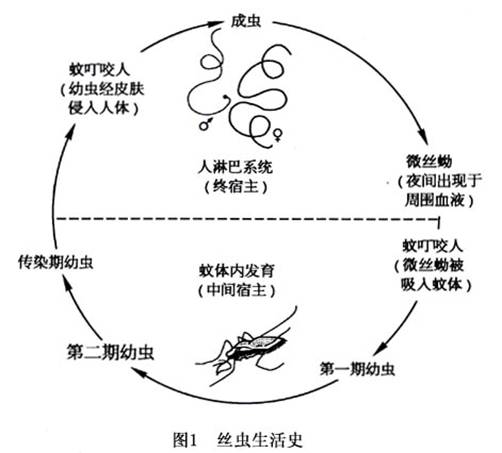 淋巴丝虫病