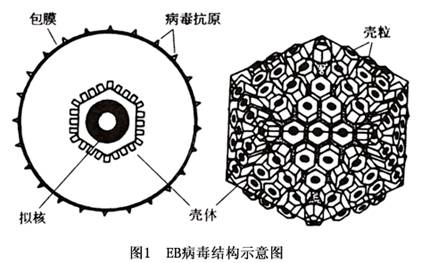 传染性单核细胞增多症