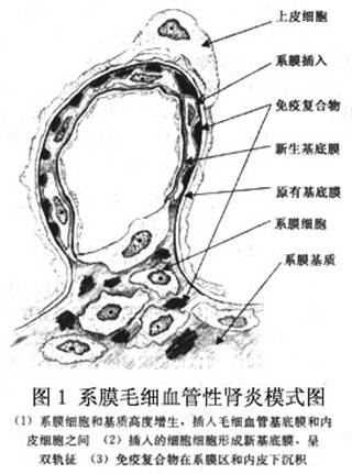 蜕皮甾酮对高糖培养大鼠肾小球系膜细胞影响机制的研究