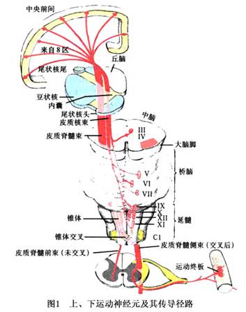 交叉性瘫痪 www.guahao.com