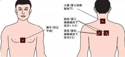 喜讯|"冬病夏治"三伏贴火热预约中