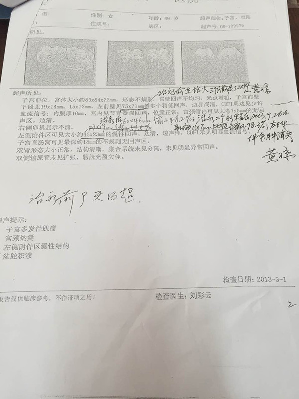 我的愿景:让女性朋友挥别子宫肌瘤的梦魇