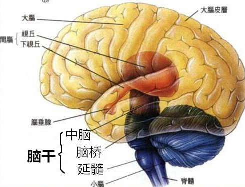 脑干出血可能会由哪些并发症导致