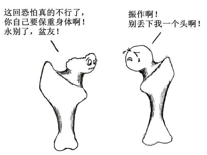 漫画说关节(二):股骨头坏死