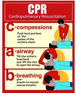 (二) cpr(cardiopulmonary resuscitation ,  心肺复苏)的步骤: c