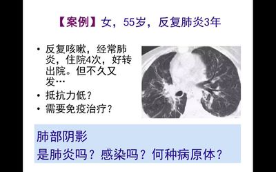 一些以往凭体格检查和普通胸部x线片子,不会被发现的所谓"慢性肺炎"