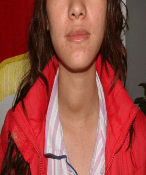 广东 东莞 东莞市东华医院 李君久 医生文章 文章详情