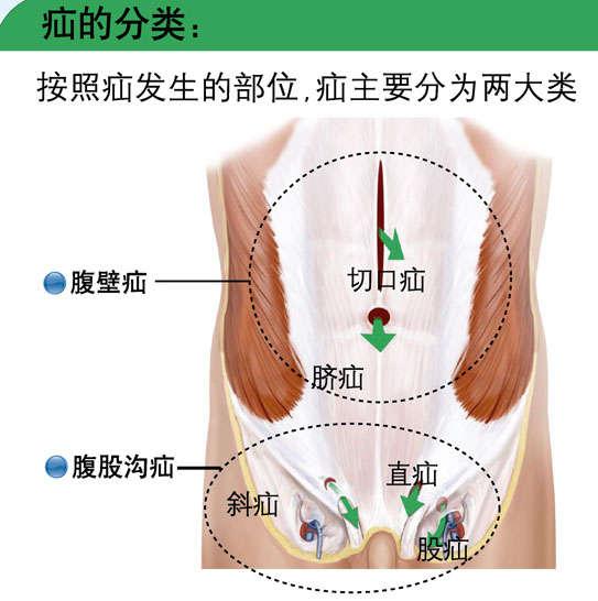 男婴儿小肠气症状图片图片