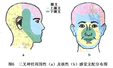 躯体感觉障碍