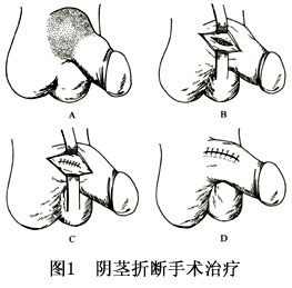 折jb图片