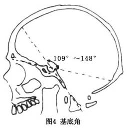 疾病百科 疾病介紹 (3)bull角:硬顎平面與寰椎平面所成的角度(圖3