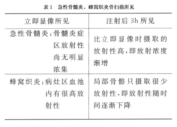 急性血源性骨髓炎