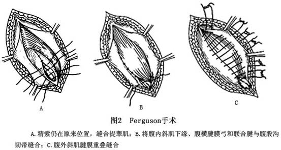 提睾扶阳法图片