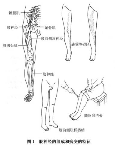 感觉支  有以下两个分支:     (1)股前皮神经:分布于大腿下2/3前内侧