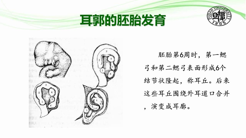 耳郭整形与美容系列(一)——耳的解剖与耳郭畸形概述
